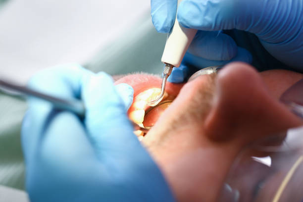 Best Walk-In Emergency Dental Services in Trowbridge Park, MI