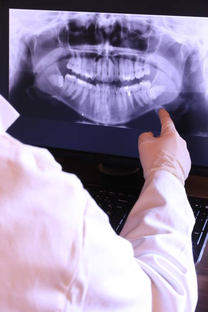 Best Emergency Dental Care for Sports Injuries in Trowbridge Park, MI