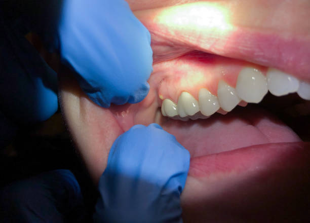 Best After-Hours Dental Care in Trowbridge Park, MI