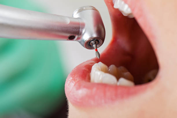  Trowbridge Park, MI Emergency Dentist Pros